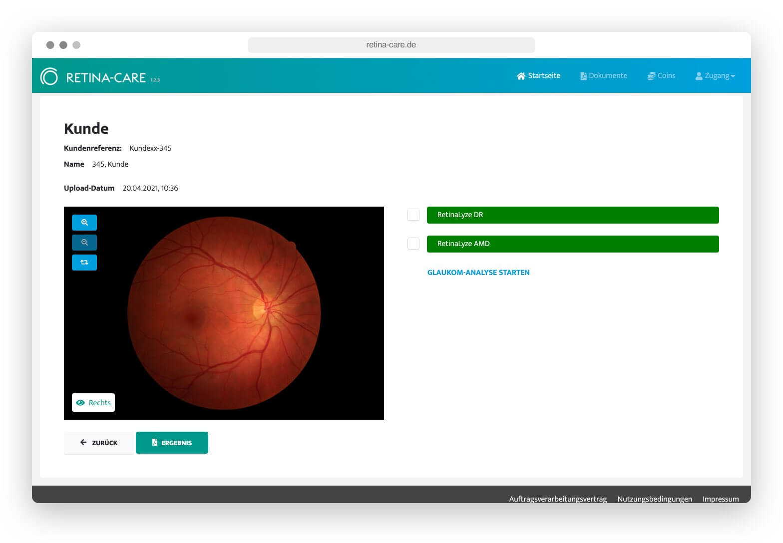 Retina Care Plattform Screenshot 4