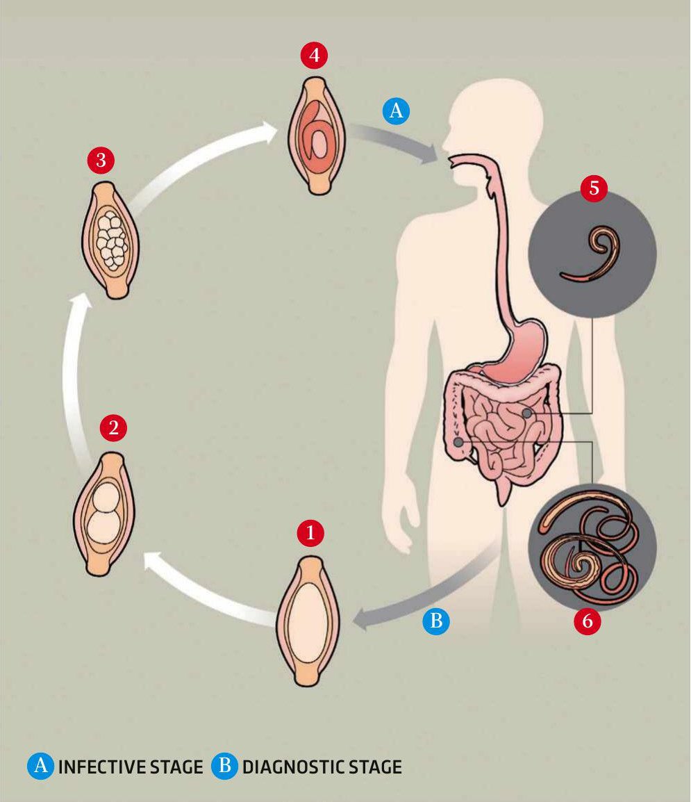 Parasite from fossilised Viking poo has genome mapped BBC Science Focus