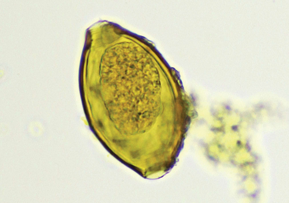 Parasite from fossilised Viking poo has genome mapped BBC Science Focus